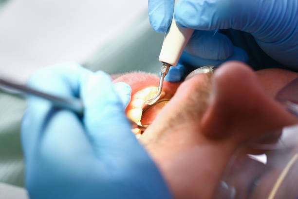 Best Emergency Treatment for Toothache in Lowes Island, VA