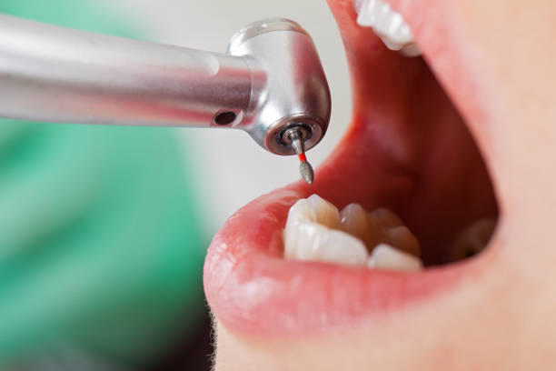 Best Pediatric Emergency Dentist in Lowes Island, VA